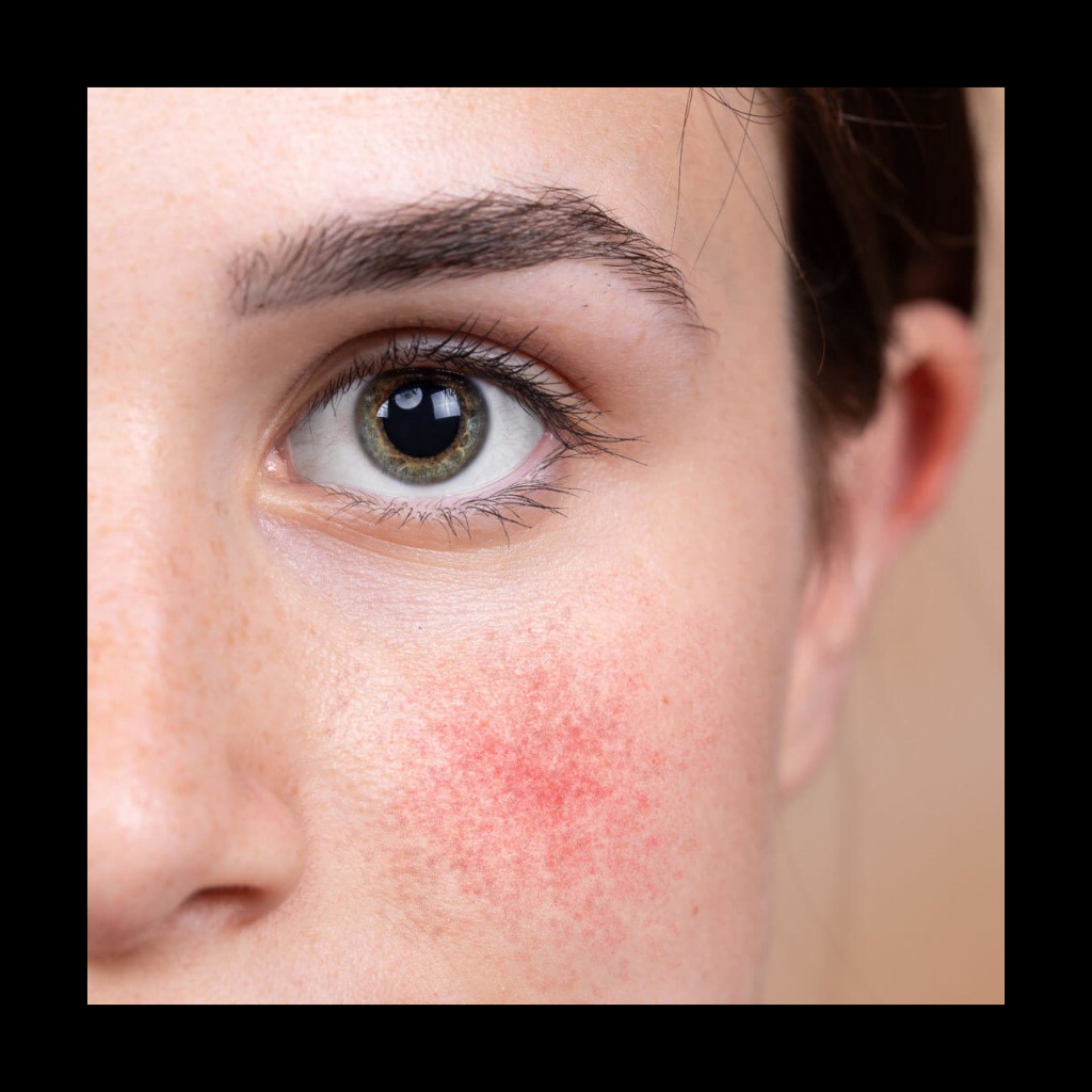 Dermatology Near Me In Salem  main image