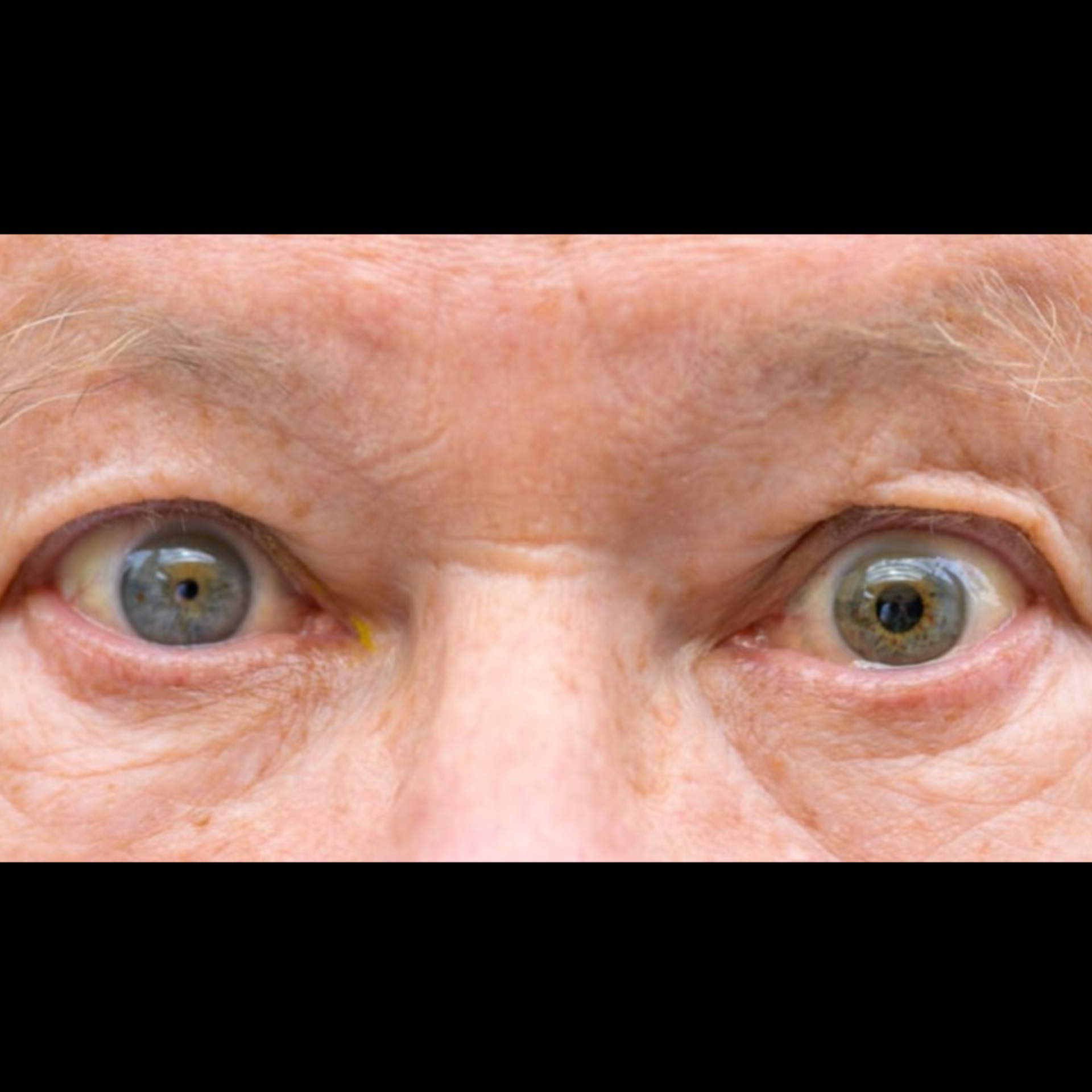 Eye Doctor Near Me In Salem  main image