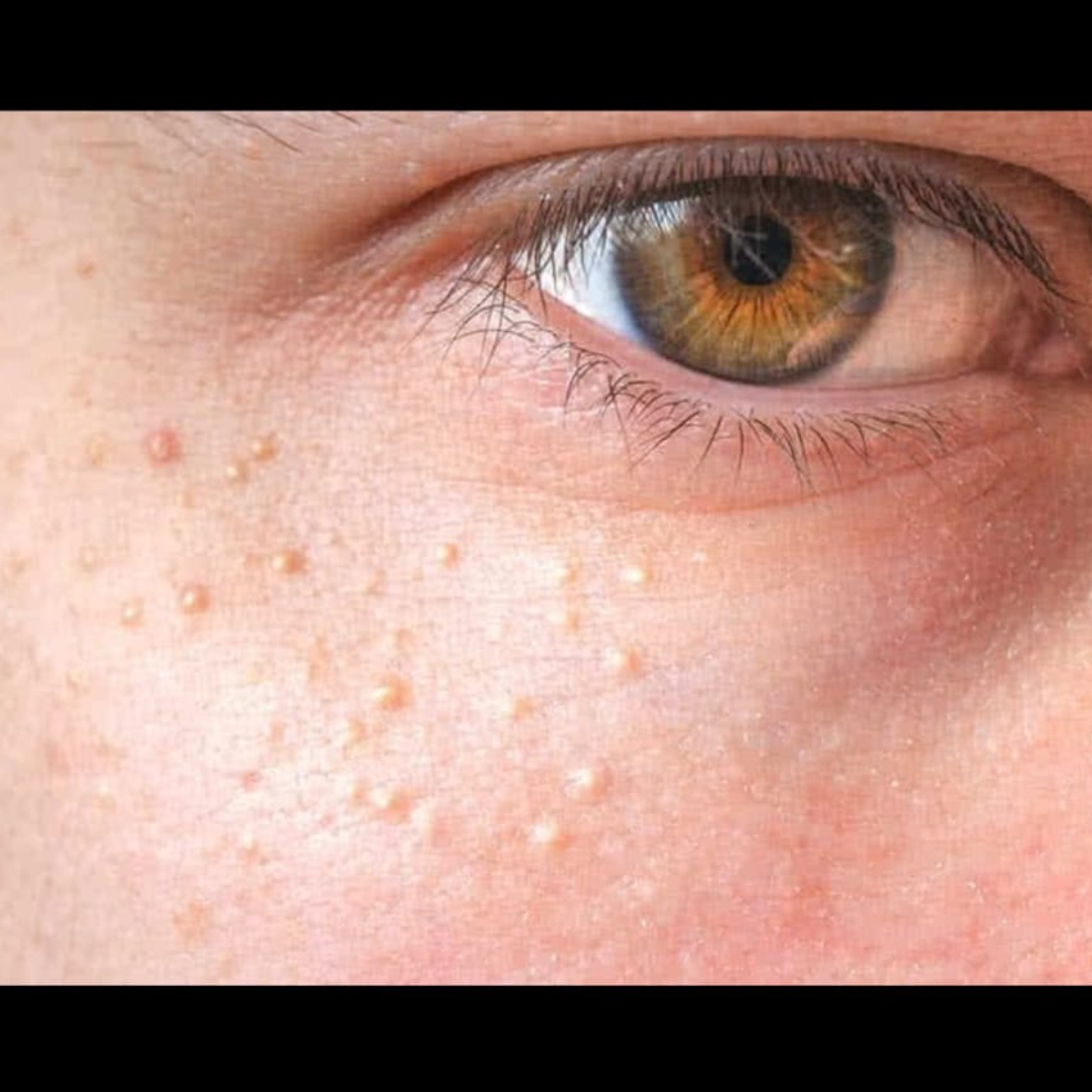 Skin Doctor Near Me In Salem  main image