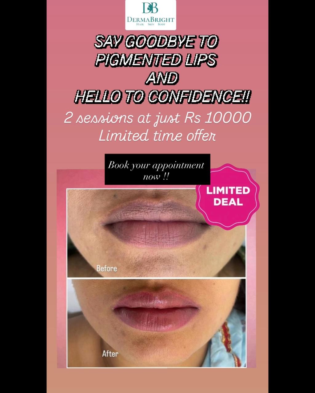 Get you Lip Micropigmentation done at DermaBright, Baner main image