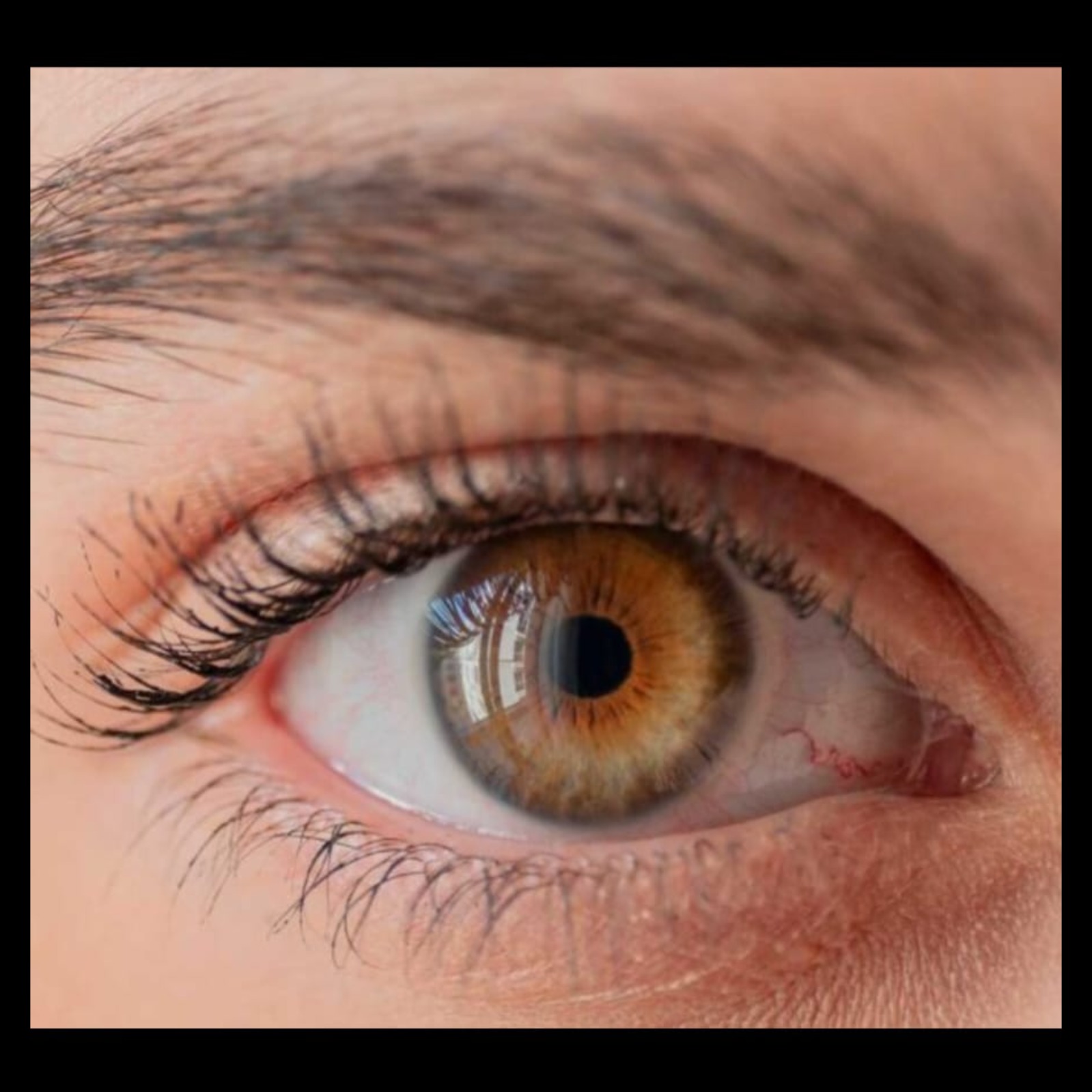 Eye Doctor Near Me In Salem Seelanaickenpatti  main image