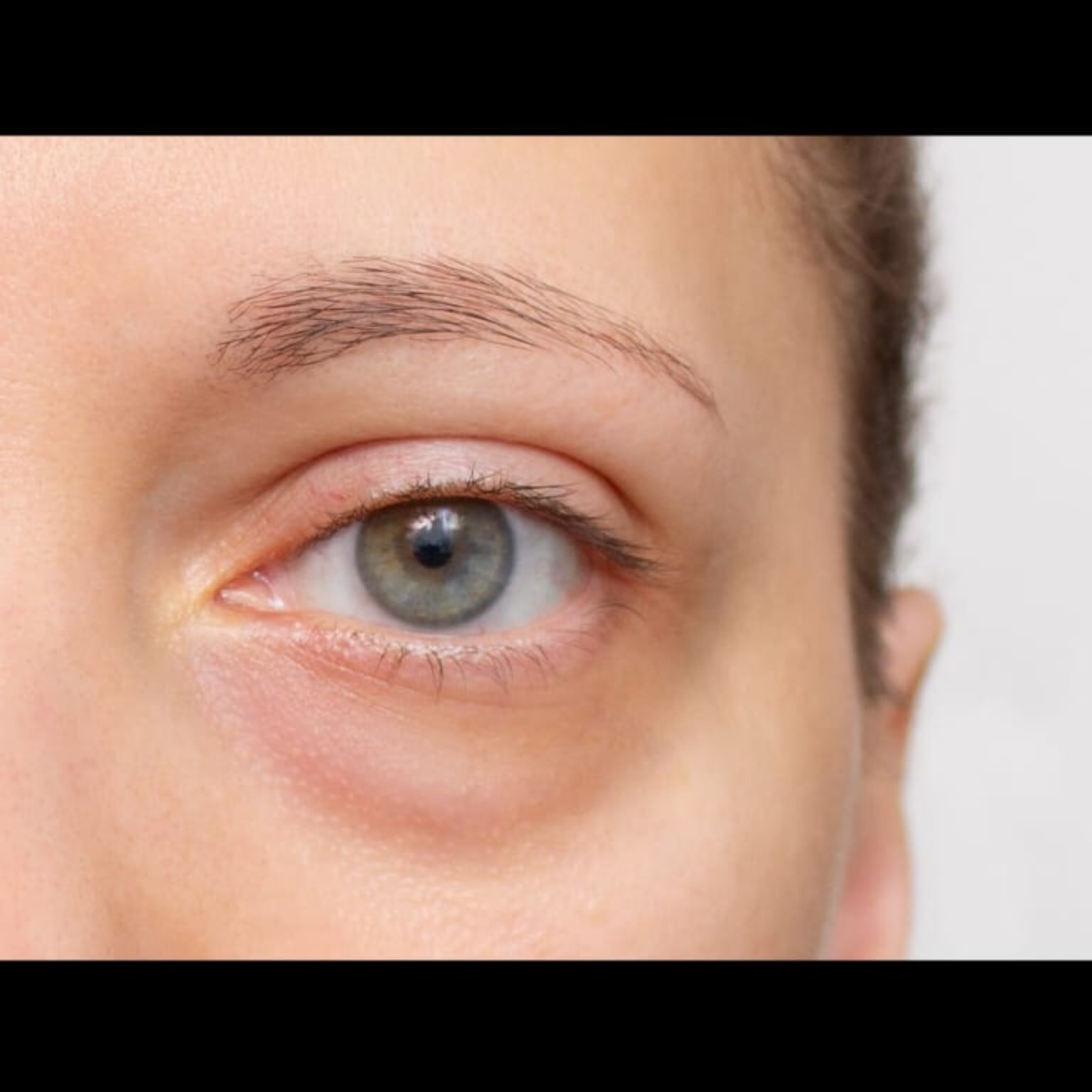 Eye Doctor Near Me In Salem  main image