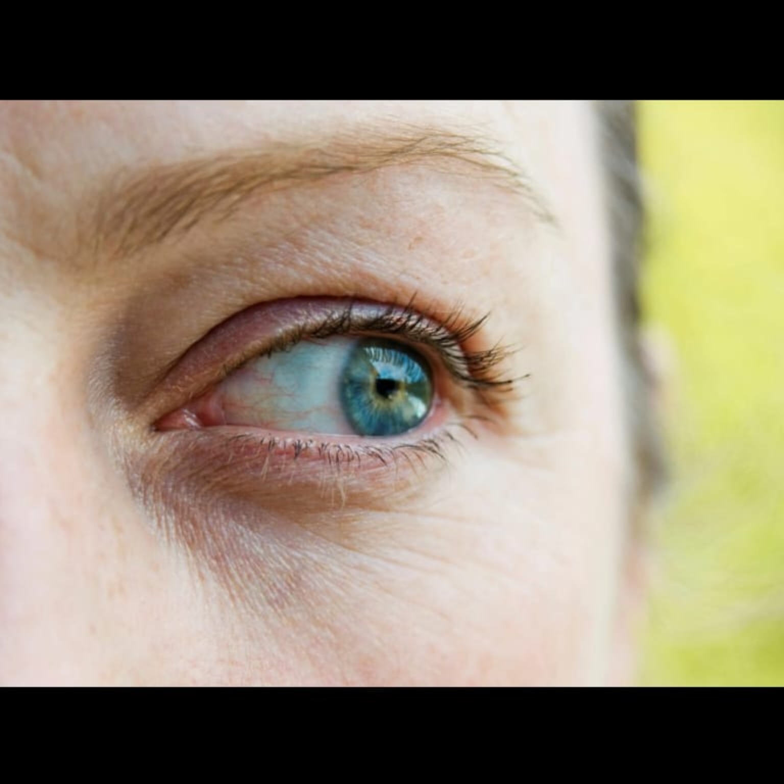 Eye Doctor Near Me In Salem  main image