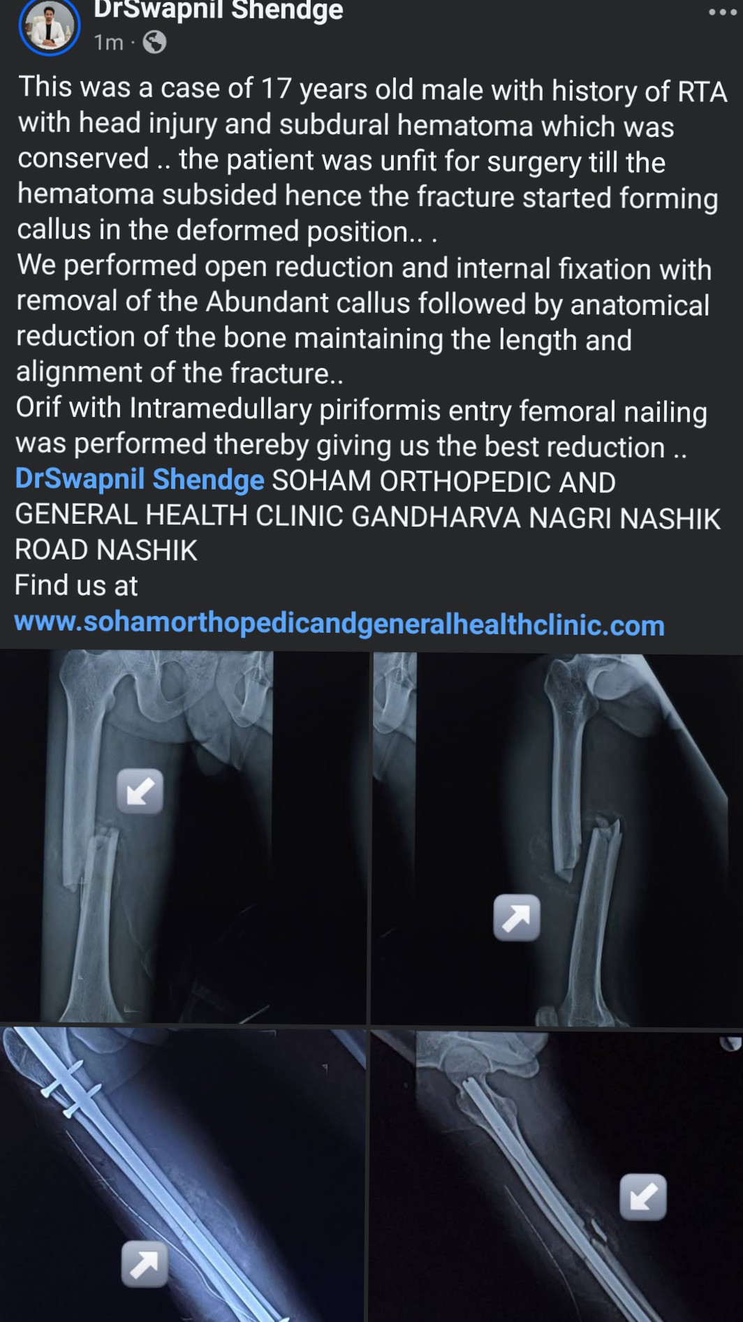 a new perfect orthopediccase main image