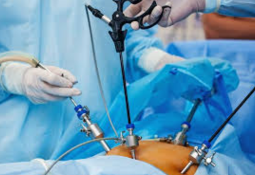Laparoscopic Surgery in Kalyan East – Modern Surgical Care with Faster Recovery main image