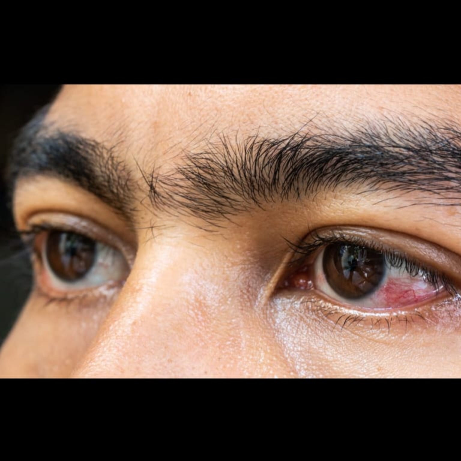 Eye Doctor Near Me In Salem  main image