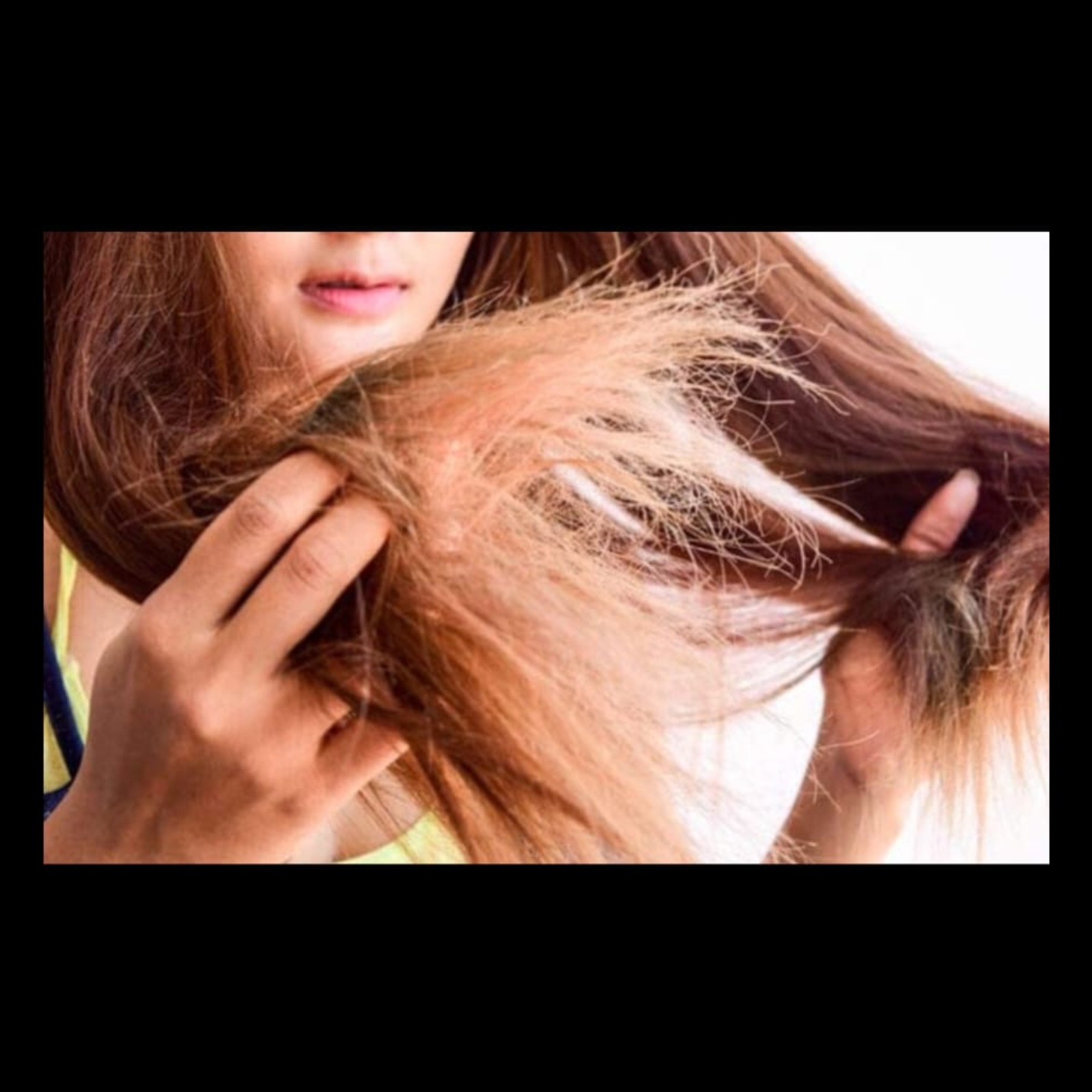 Dermatology Near Me In Salem Seelanaickenpatti  main image
