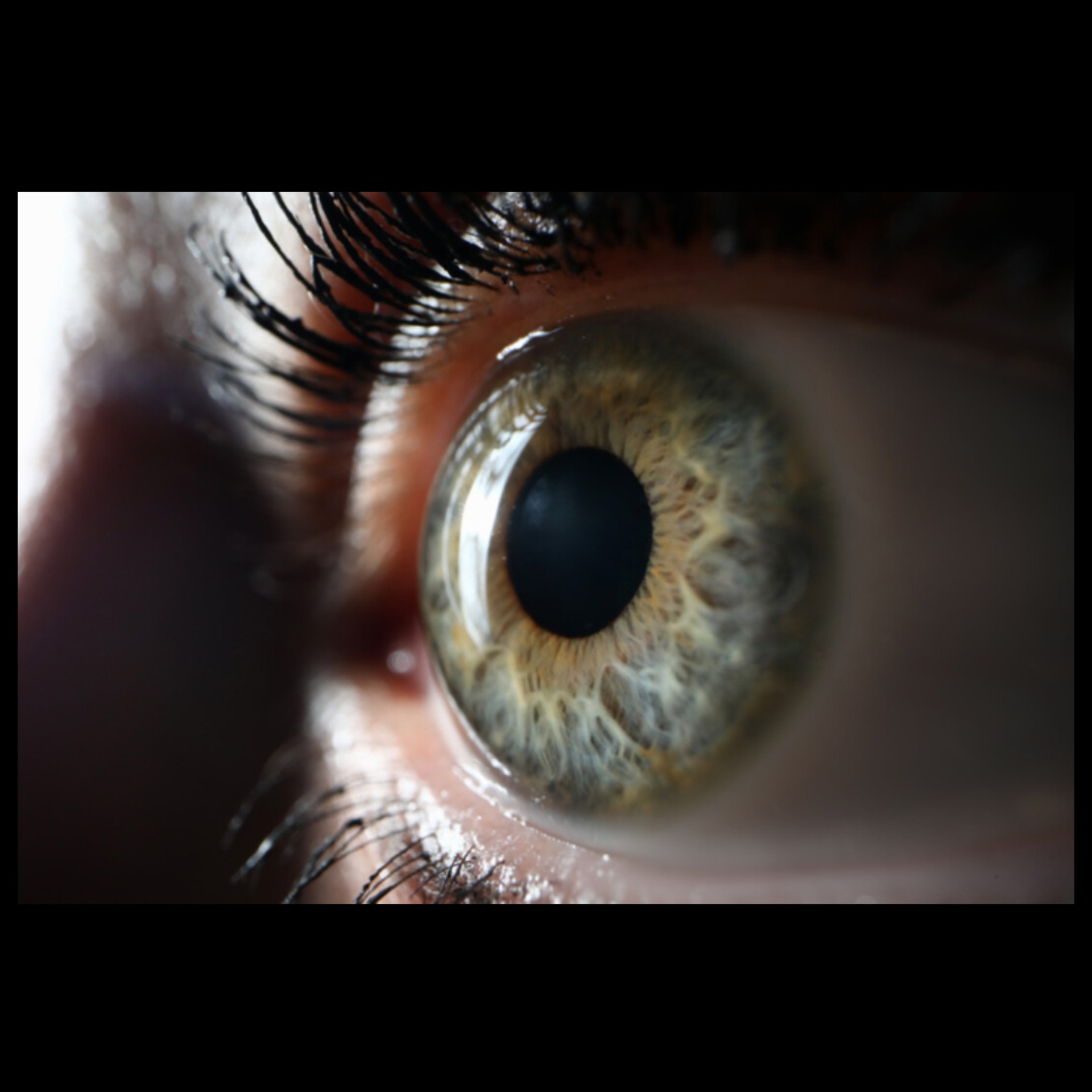 Eye Doctor Near Me In Salem  main image
