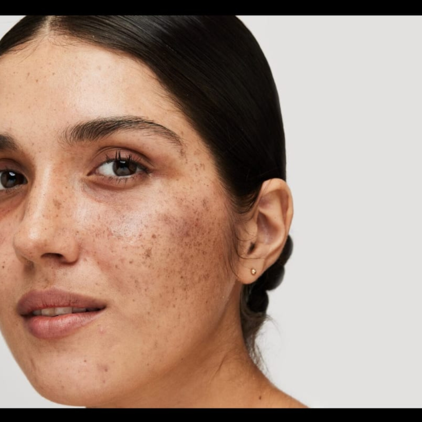 Dermatology Near Me In Salem  main image
