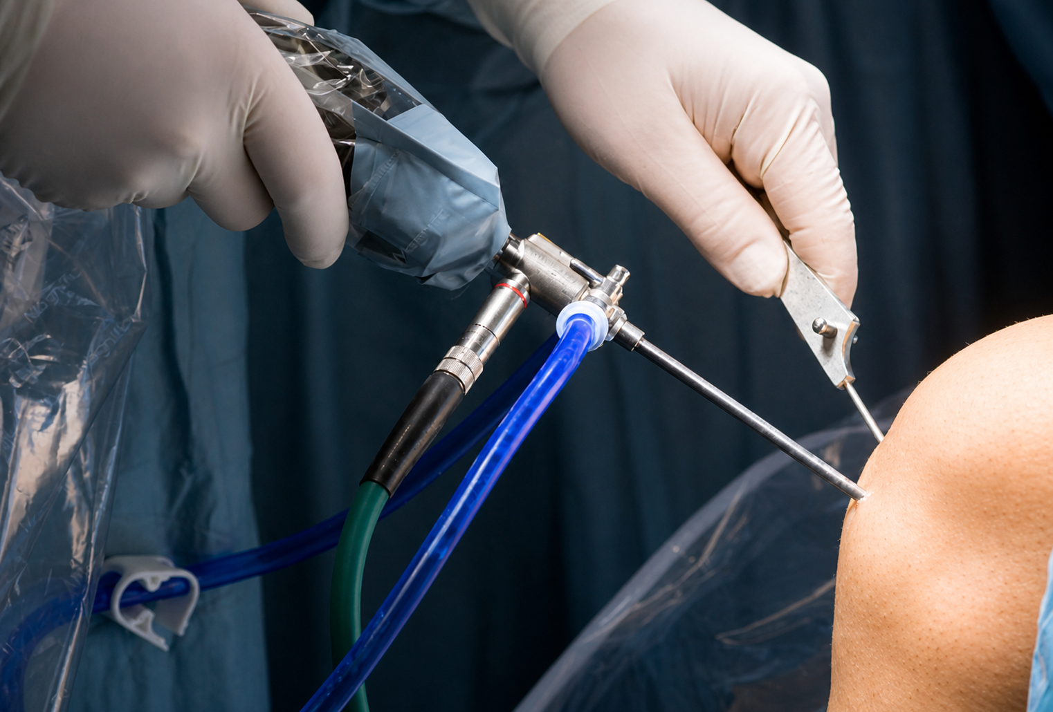 Arthroscopy Treatment for Knee Joint in Chennai – A Minimally Invasive Approach main image