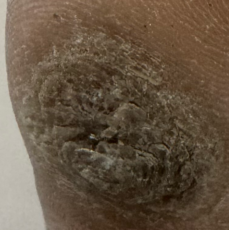 Vibha skin
