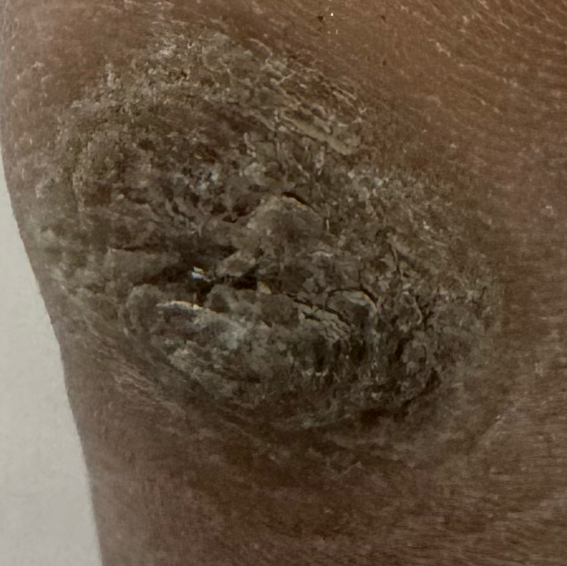 Vibha skin