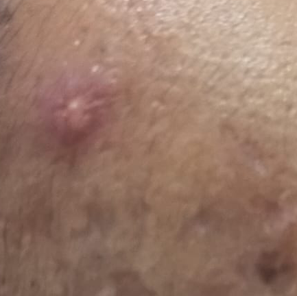Vibha skin