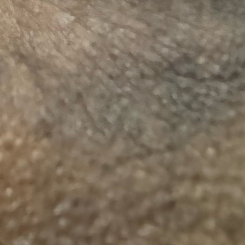 Vibha skin