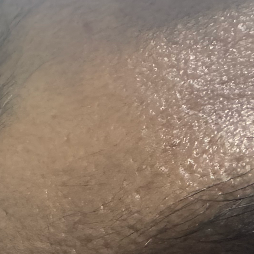 Vibha skin