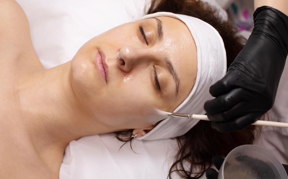 Chemical Peel Cost in Chennai – Investing in Healthier Skin main image