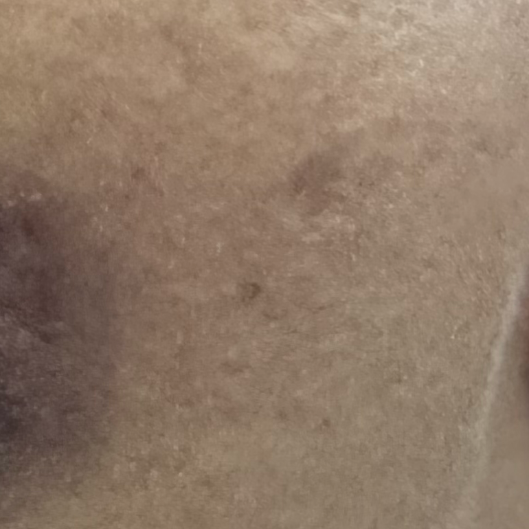 Vibha skin