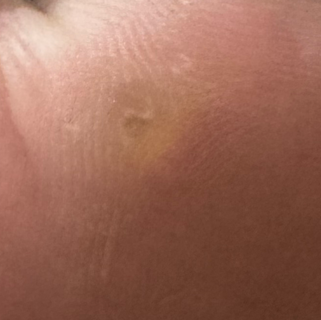 Vibha skin