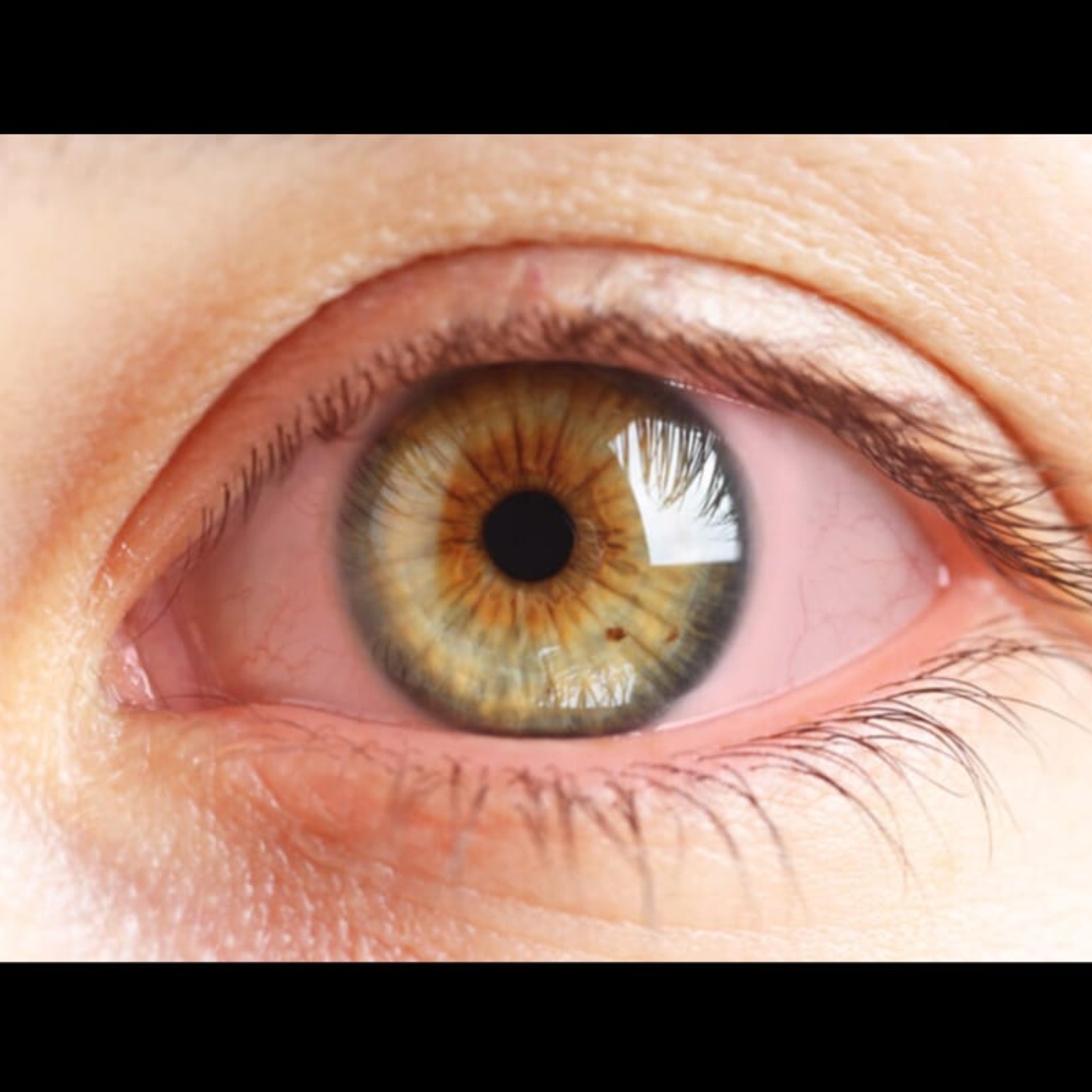 Eye Doctor Near Me In Salem  main image