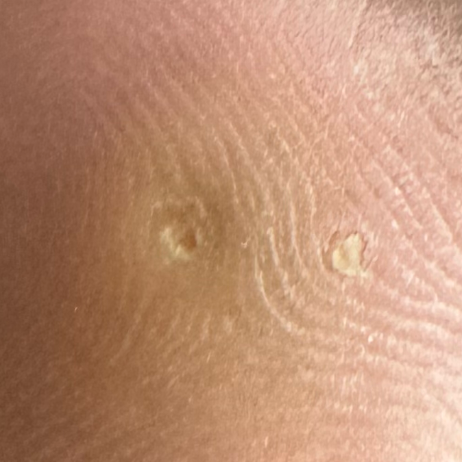 Vibha skin