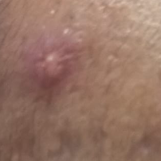 Vibha skin