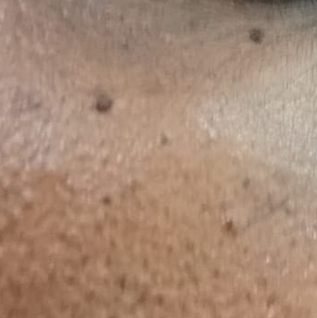 Vibha skin