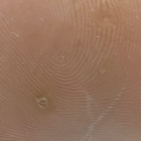 Vibha skin