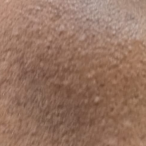 Vibha skin