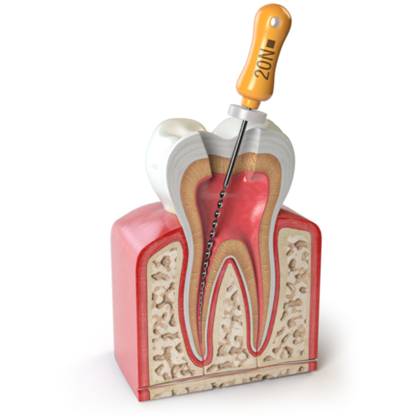 Best Root Canal Specialist In Nagpur – Advanced Care With Minimal Discomfort main image