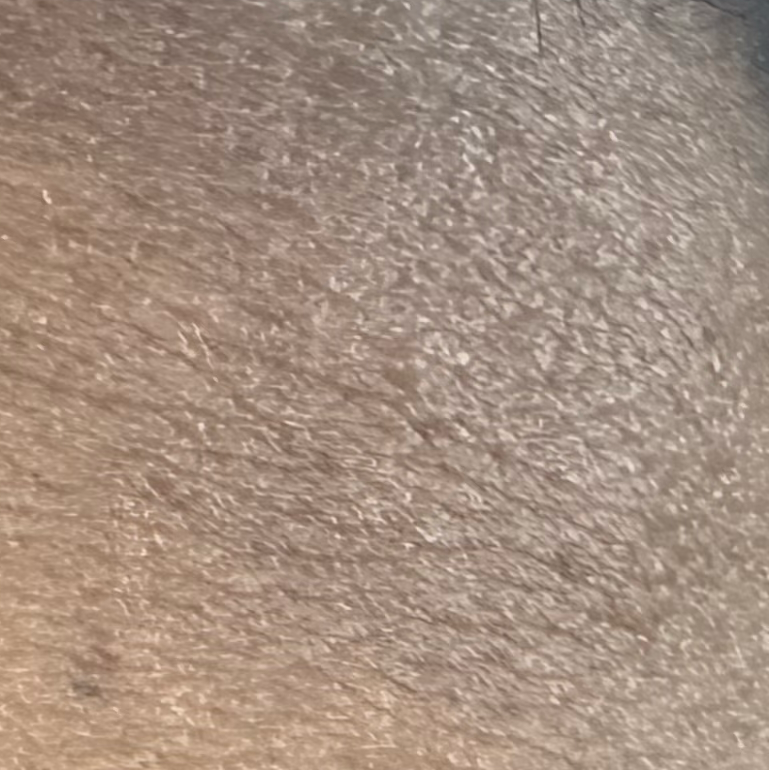 Vibha skin