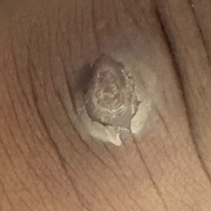 Vibha skin