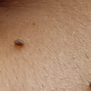 Vibha skin