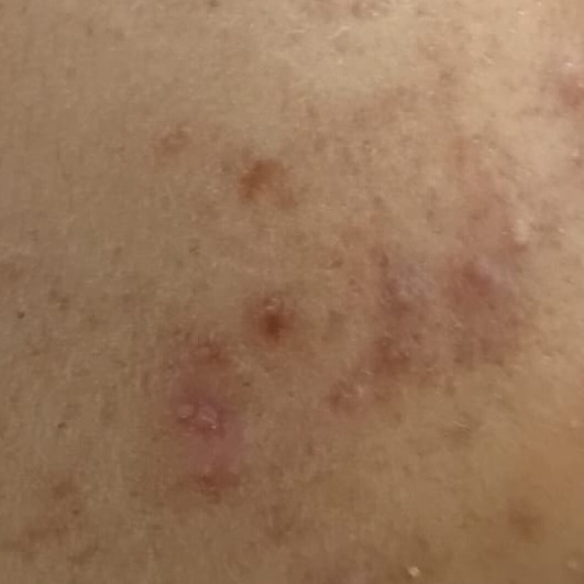 Vibha skin