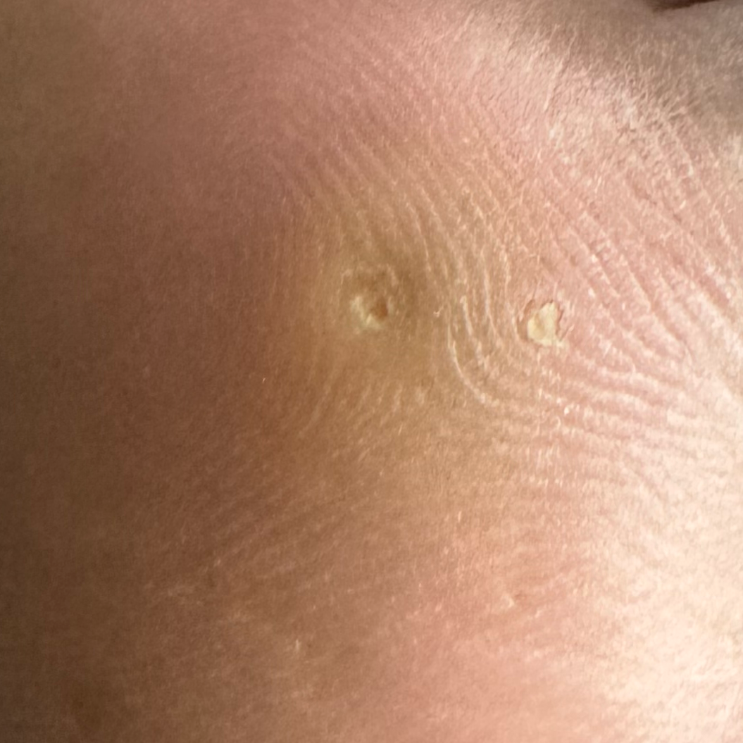 Vibha skin