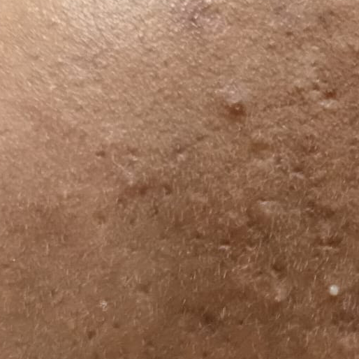 Vibha skin