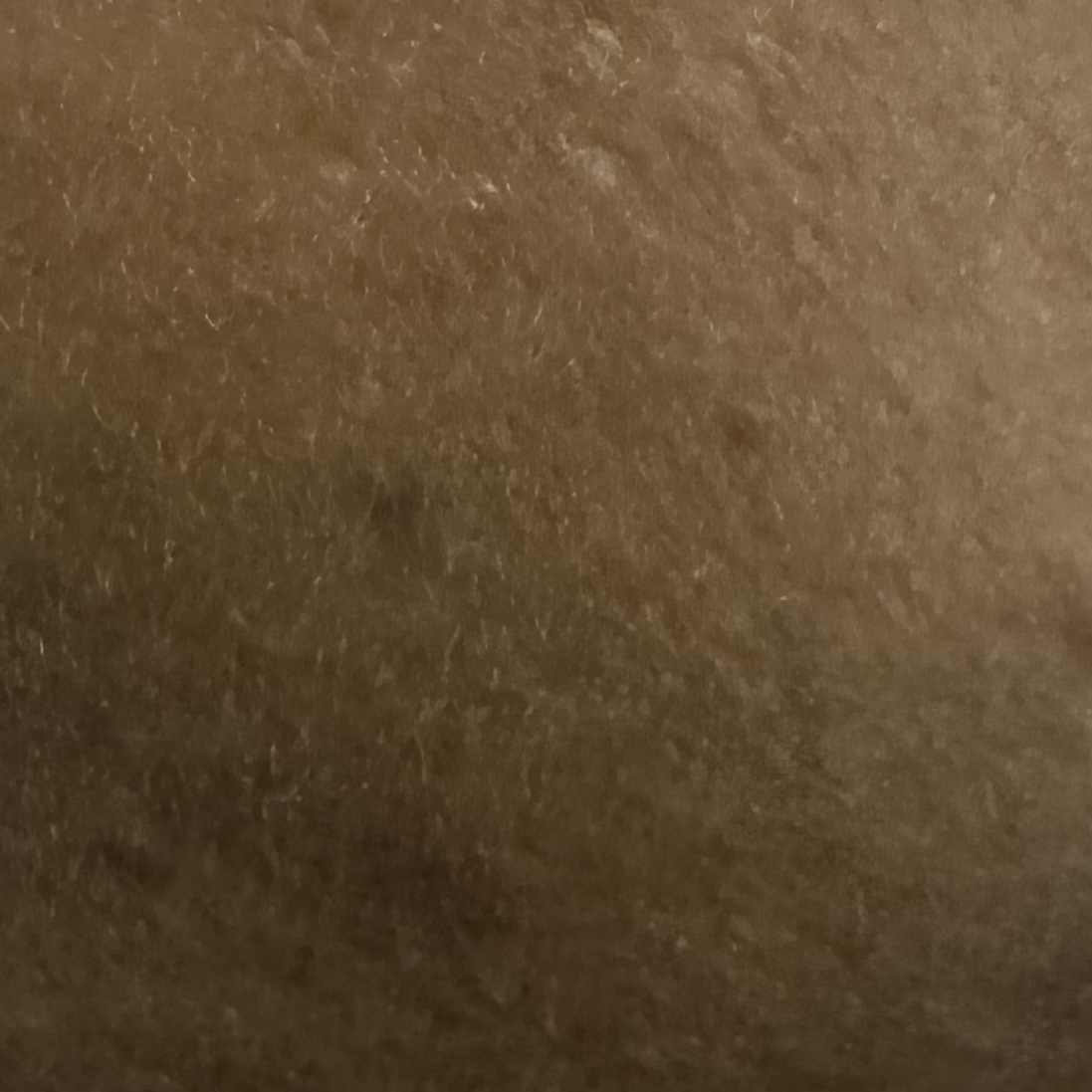 Vibha skin