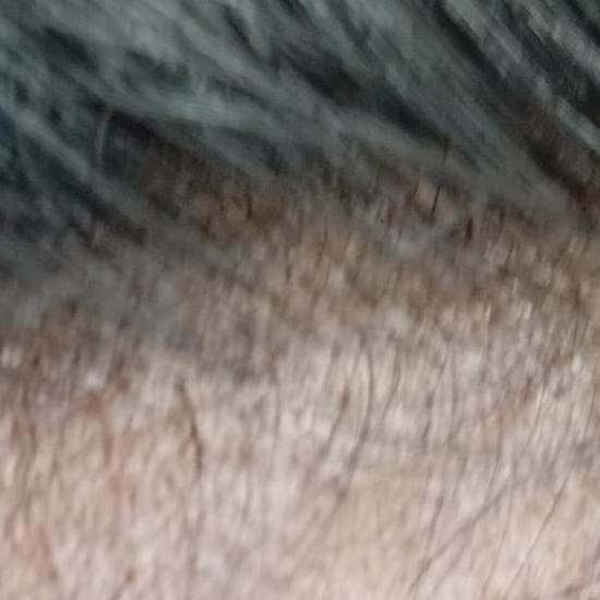 Vibha skin