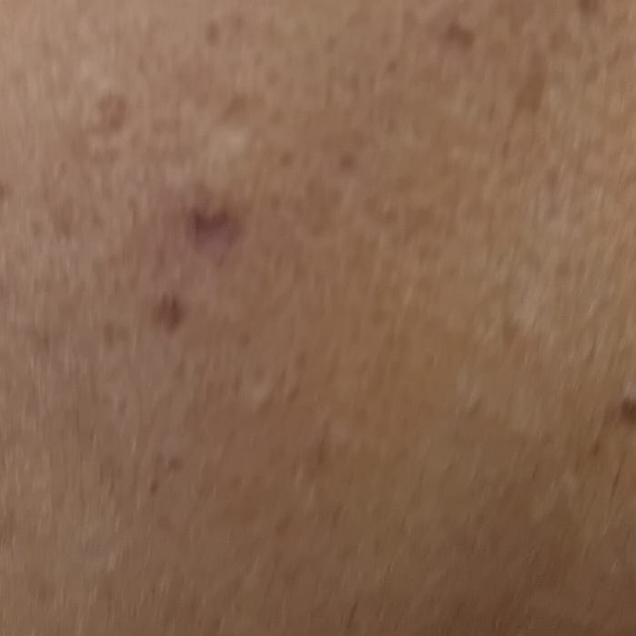 Vibha skin