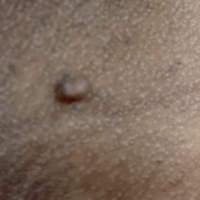 Vibha skin
