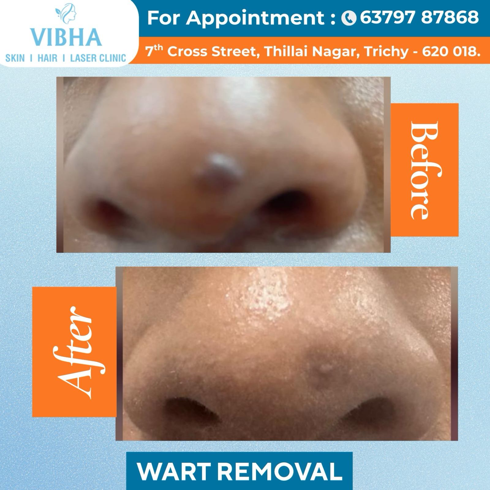 Vibha skin