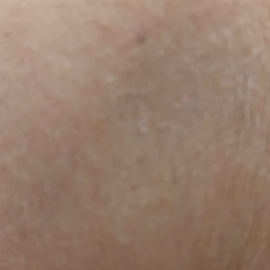 Vibha skin