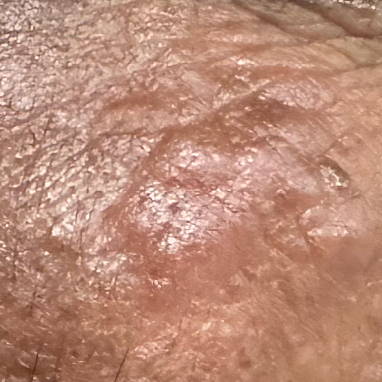 Vibha skin