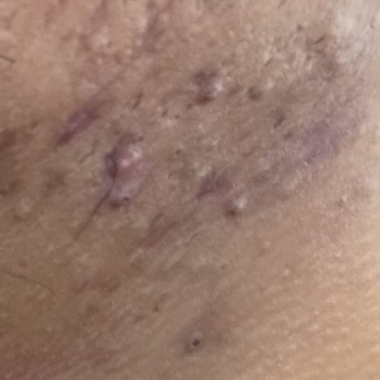 Vibha skin