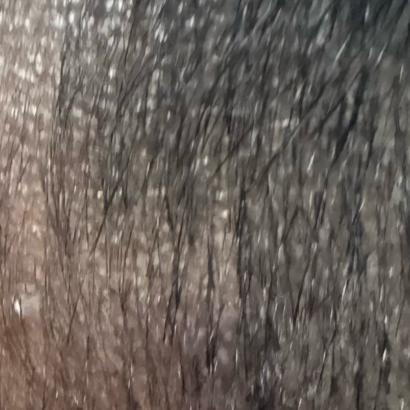 Vibha skin