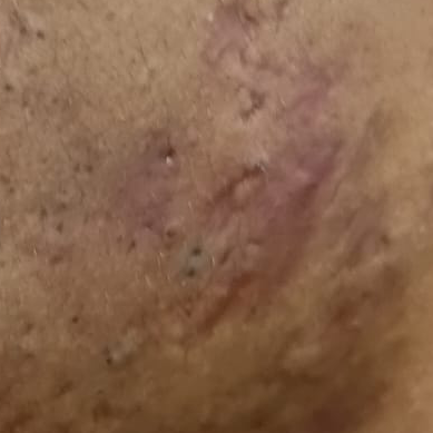 Vibha skin