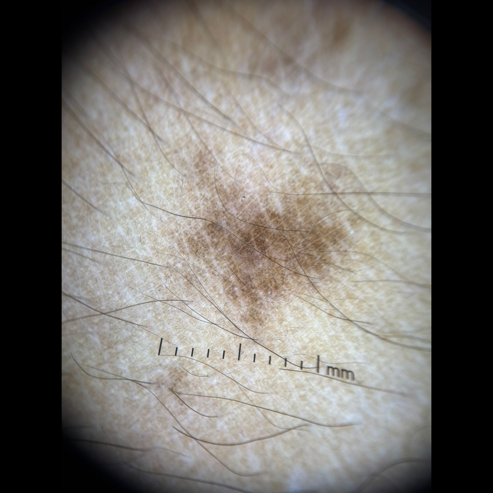 Dermatolog