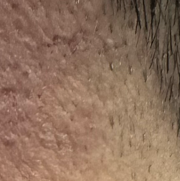 Vibha skin
