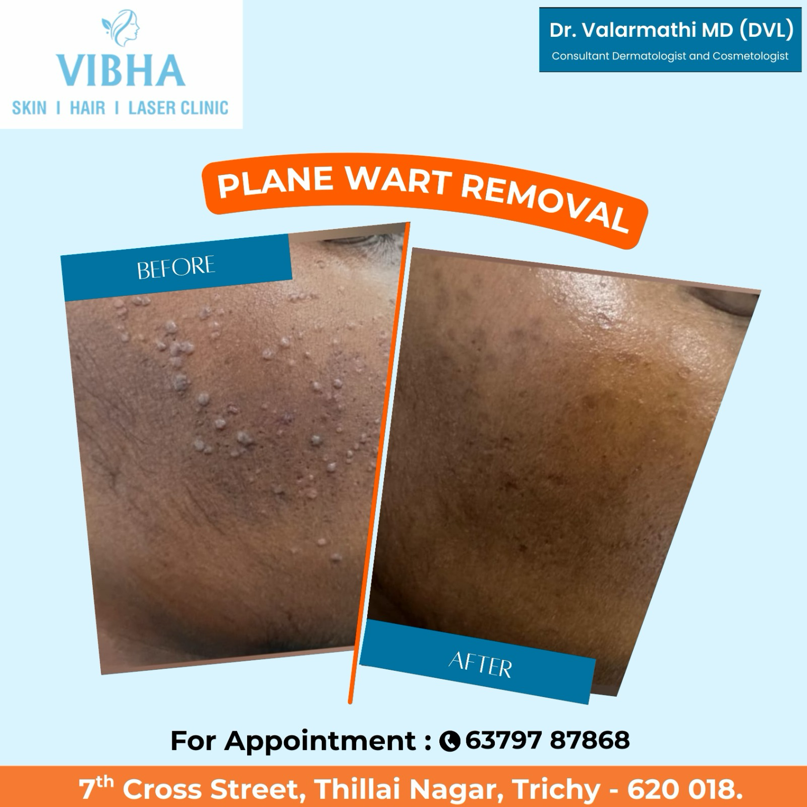 Vibha skin