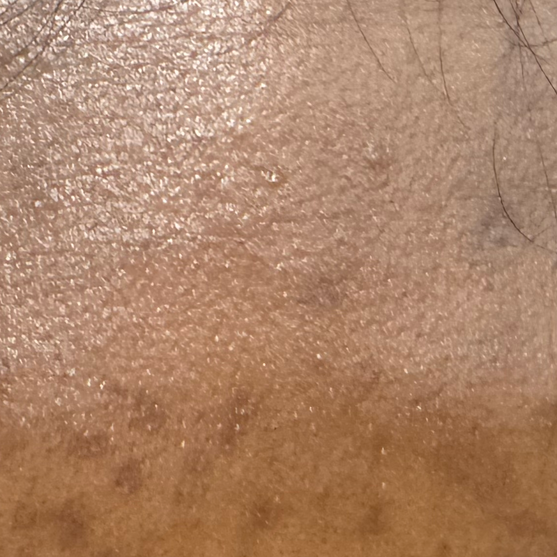 Vibha skin