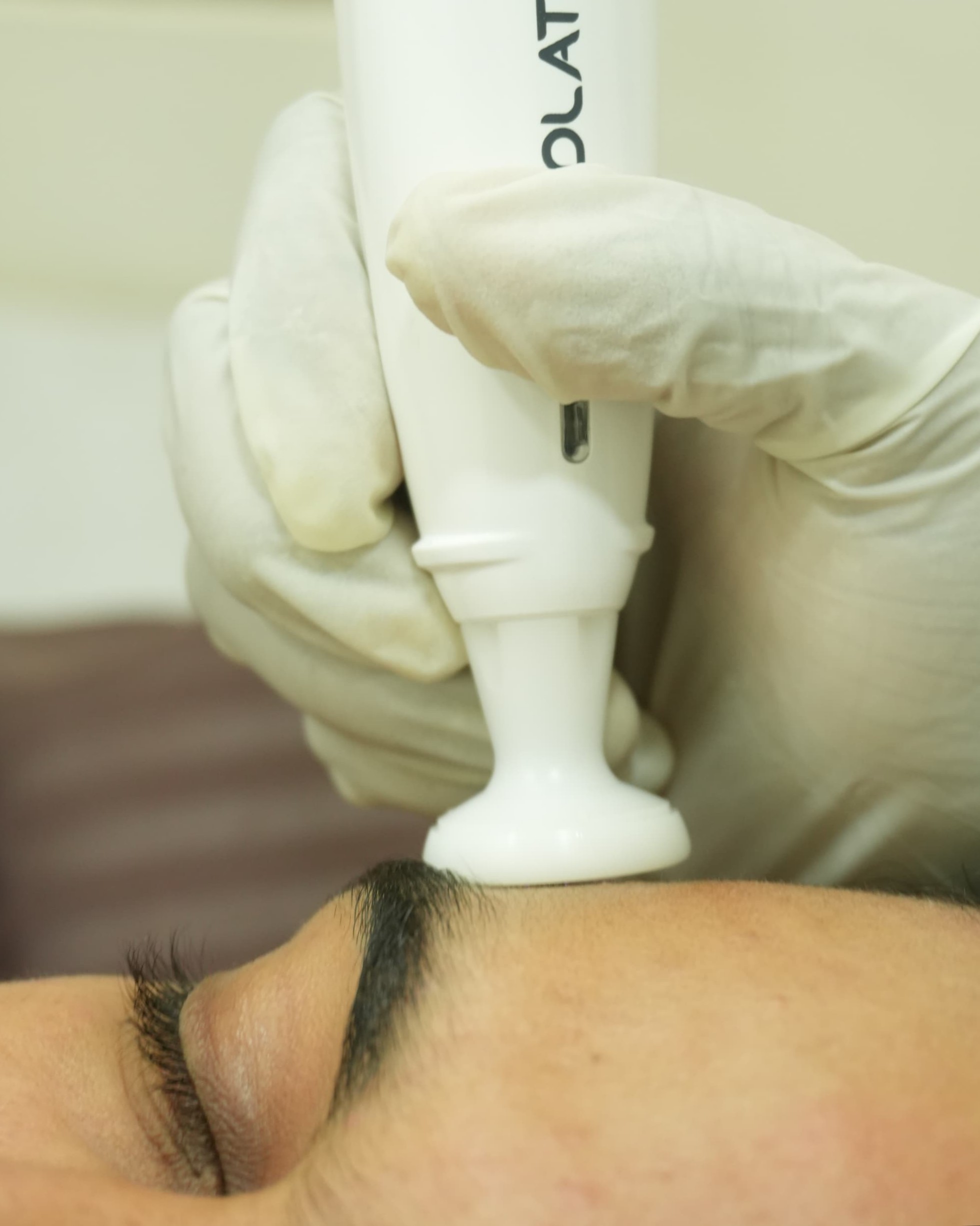 best skin clinic Trichy main image